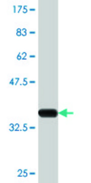 Monoclonal Anti-CYP24A1, (C-terminal) antibody produced in mouse clone 1E1, purified immunoglobulin, buffered aqueous solution