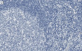 Anti-MCM7 Antibody, clone 1C20 ZooMAb&#174; Rabbit Monoclonal recombinant, expressed in HEK 293 cells