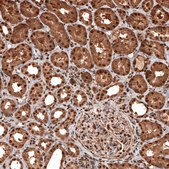 Monoclonal Anti-GAPDH antibody produced in mouse Prestige Antibodies&#174; Powered by Atlas Antibodies, clone CL3266, purified immunoglobulin, buffered aqueous glycerol solution