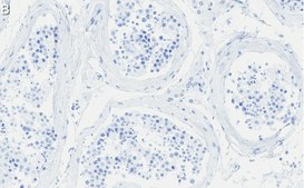 Anti-Anillin Antibody, clone 2C6 ZooMAb&#174; Rabbit Monoclonal recombinant, expressed in HEK 293 cells