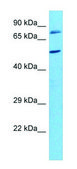 Anti-GHR (C-terminal) antibody produced in rabbit affinity isolated antibody