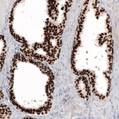 Monoclonal Anti-GRHL2 antibody produced in mouse Prestige Antibodies&#174; Powered by Atlas Antibodies, clone CL3760, purified immunoglobulin, buffered aqueous glycerol solution