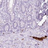 Anti-PRPH antibody produced in rabbit Prestige Antibodies&#174; Powered by Atlas Antibodies, affinity isolated antibody, buffered aqueous glycerol solution