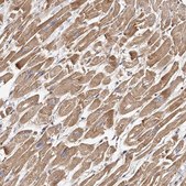 Anti-USP21 antibody produced in rabbit Prestige Antibodies&#174; Powered by Atlas Antibodies, affinity isolated antibody, buffered aqueous glycerol solution