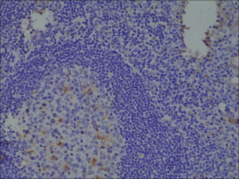Anti-Spastin antibody, Rabbit monoclonal recombinant, expressed in HEK 293 cells, clone RM346, purified immunoglobulin
