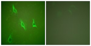 Anti-CASP10 antibody produced in rabbit affinity isolated antibody