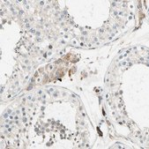 Anti-LPCAT2 antibody produced in rabbit Prestige Antibodies&#174; Powered by Atlas Antibodies, affinity isolated antibody, buffered aqueous glycerol solution