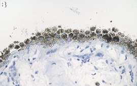 Anti-RPE65 Antibody, clone 401.8B11.3D9 ZooMAb&#174; Mouse Monoclonal recombinant, expressed in HEK 293 cells