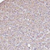 Anti-CAT antibody produced in rabbit Prestige Antibodies® Powered by Atlas Antibodies, affinity isolated antibody, buffered aqueous glycerol solution