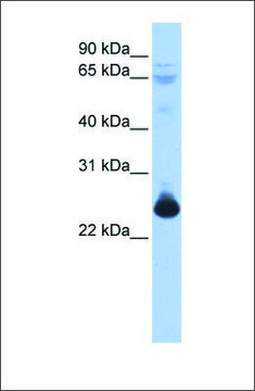 Anti-TCEAL1 antibody produced in rabbit affinity isolated antibody