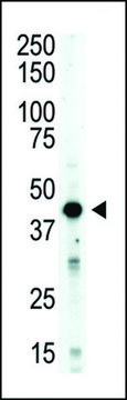 ANTI-AURORA-B (ARK/STK12) (CENTER) antibody produced in rabbit IgG fraction of antiserum, buffered aqueous solution