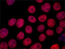 Anti-PSPC1 (N-terminal) antibody produced in rabbit ~1.0&#160;mg/mL, affinity isolated antibody