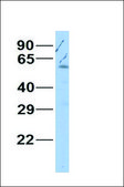 Anti-GATA3 antibody produced in rabbit affinity isolated antibody