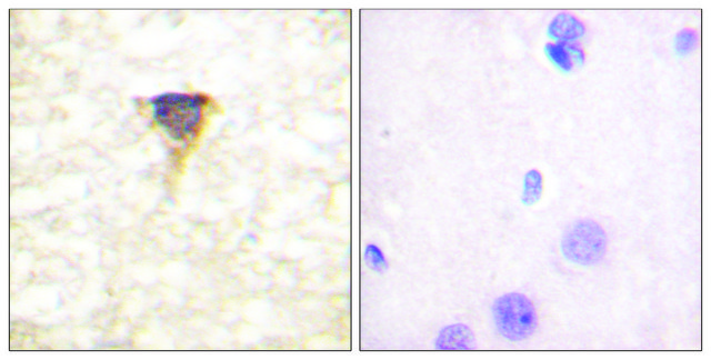 Anti-CAMK4 antibody produced in rabbit affinity isolated antibody
