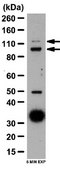 Anti-Autotaxin Antibody from rabbit, purified by affinity chromatography