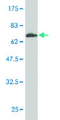 Monoclonal Anti-HSD3B1 antibody produced in mouse clone 3C11-D4, purified immunoglobulin, buffered aqueous solution