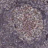 Anti-LONP1 antibody produced in rabbit Ab2, Prestige Antibodies&#174; Powered by Atlas Antibodies, affinity isolated antibody, buffered aqueous glycerol solution
