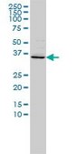 Monoclonal Anti-FOXR2 antibody produced in mouse clone 2C1, purified immunoglobulin, buffered aqueous solution