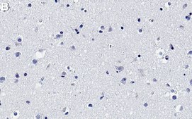 Anti-MFF Antibody, clone 1E18 ZooMAb&#174; Rabbit Monoclonal recombinant, expressed in HEK 293 cells