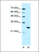 Anti-FOXR2 antibody produced in rabbit IgG fraction of antiserum