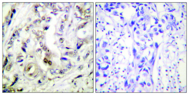 Anti-Progesterone Receptor antibody produced in rabbit affinity isolated antibody