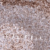 Anti-TSPO antibody produced in mouse Prestige Antibodies&#174; Powered by Atlas Antibodies, clone CL13359, purified by using Protein A, buffered aqueous glycerol solution
