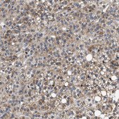Anti-PDP1 antibody produced in rabbit Prestige Antibodies&#174; Powered by Atlas Antibodies, affinity isolated antibody, buffered aqueous glycerol solution