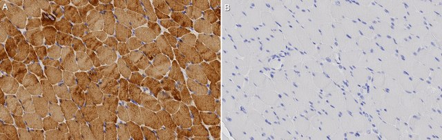 Anti-Tropomyosin Antibody, clone 1C5 ZooMAb&#174; Rabbit Monoclonal recombinant, expressed in HEK 293 cells