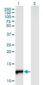 Monoclonal Anti-CYP24A1, (C-terminal) antibody produced in mouse clone 1E1, purified immunoglobulin, buffered aqueous solution