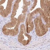Anti-RNPEP antibody produced in rabbit Prestige Antibodies&#174; Powered by Atlas Antibodies, affinity isolated antibody