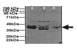 Anti-M6PR antibody produced in rabbit IgG fraction of antiserum