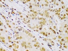 Anti-IKK beta antibody produced in rabbit