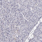 Anti-TLR8 antibody produced in rabbit Prestige Antibodies&#174; Powered by Atlas Antibodies, affinity isolated antibody, buffered aqueous glycerol solution