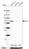 Anti-AHSG antibody produced in rabbit Prestige Antibodies&#174; Powered by Atlas Antibodies, affinity isolated antibody, buffered aqueous glycerol solution