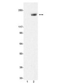 Anti-phospho-erbB-2/HER-2 (Tyr1248) Antibody Upstate&#174;, from rabbit