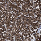 Anti-VPS13A antibody produced in rabbit Prestige Antibodies&#174; Powered by Atlas Antibodies, affinity isolated antibody, buffered aqueous glycerol solution, Ab1