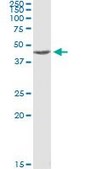 ANTI-MAPKAPK2 antibody produced in mouse clone 1F9, purified immunoglobulin, buffered aqueous solution