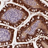 Anti-CES2 antibody produced in rabbit Prestige Antibodies&#174; Powered by Atlas Antibodies, affinity isolated antibody, buffered aqueous glycerol solution