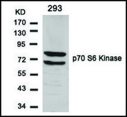 Anti-RPS6KB1 (Ab-424) antibody produced in rabbit affinity isolated antibody