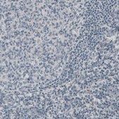 Monoclonal Anti-NEFH antibody produced in mouse Prestige Antibodies&#174; Powered by Atlas Antibodies, clone CL2671, purified immunoglobulin, buffered aqueous glycerol solution