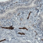 Monoclonal Anti-VWF antibody produced in mouse Prestige Antibodies&#174; Powered by Atlas Antibodies, clone CL1957, purified immunoglobulin, buffered aqueous glycerol solution