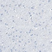 Anti-VAMP8 antibody produced in rabbit Prestige Antibodies&#174; Powered by Atlas Antibodies, affinity isolated antibody, buffered aqueous glycerol solution