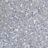 Anti-ARID5B antibody produced in rabbit Prestige Antibodies&#174; Powered by Atlas Antibodies, affinity isolated antibody, buffered aqueous glycerol solution