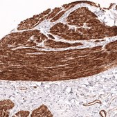 Monoclonal Anti-Myh11 Antibody Produced In Mouse Prestige Antibodies&#174; Powered by Atlas Antibodies, clone CL14617, affinity isolated antibody, buffered aqueous glycerol solution