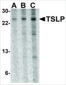 Anti-TSLP (ab3) antibody produced in rabbit affinity isolated antibody