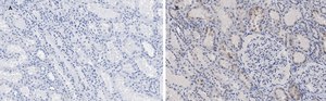Anti-c-Myc Antibody, clone 7E18, ZooMAb&#174; Rabbit Monoclonal recombinant, expressed in HEK 293 cells