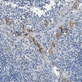 Anti-CLDN18 antibody produced in rabbit Prestige Antibodies&#174; Powered by Atlas Antibodies, affinity isolated antibody, buffered aqueous glycerol solution