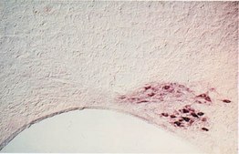 Anti-Nerve Growth Factor Receptor Antibody, extracellular, clone 192-IgG clone 192-IgG, Chemicon&#174;, from mouse