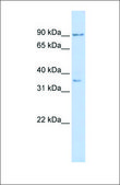 Anti-NFATC1 (ab1) antibody produced in rabbit affinity isolated antibody