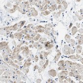 Anti-PTGIS antibody produced in rabbit affinity isolated antibody, buffered aqueous glycerol solution